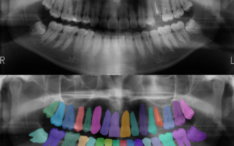 Sementation